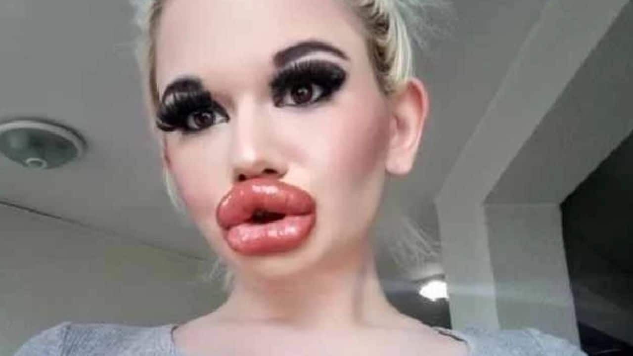 Who Is Andrea Ivanova Instagram Model Who Has The World’s Biggest Lips