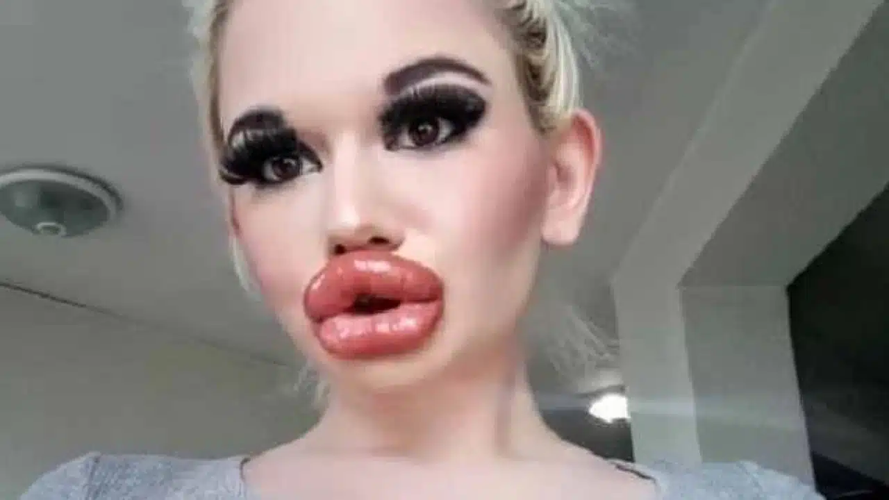 Who Is Andrea Ivanova Instagram Model Who Has The World’s Biggest Lips